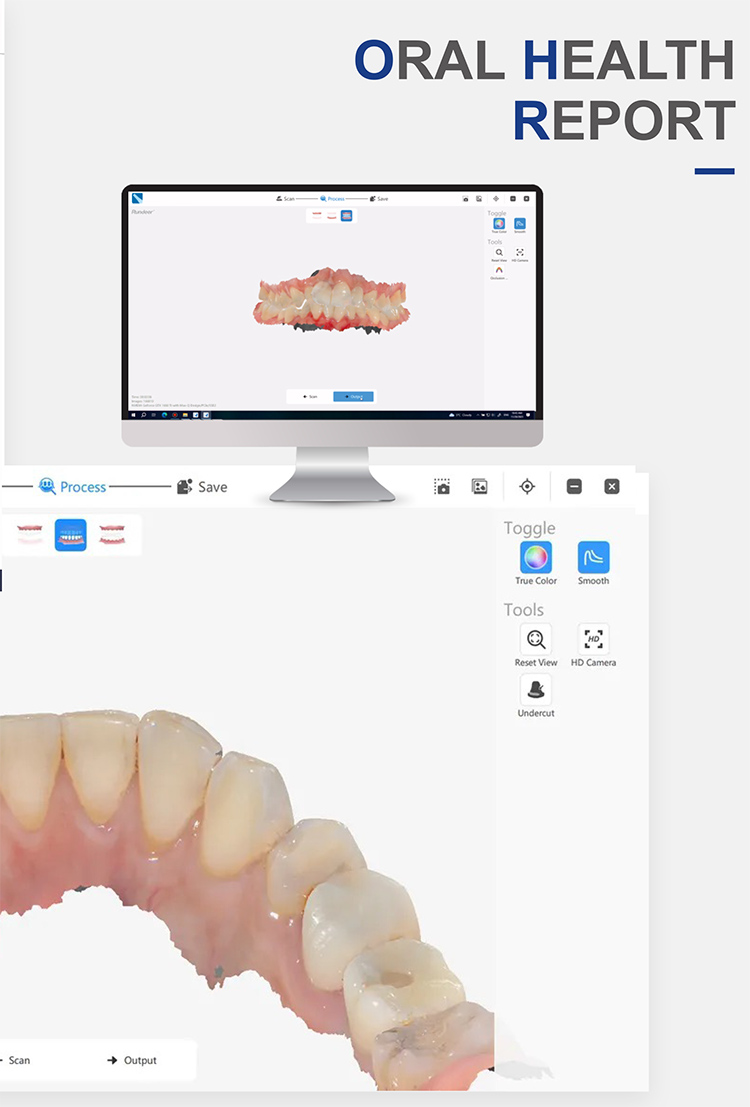 IOS33 Intraoral Scanner